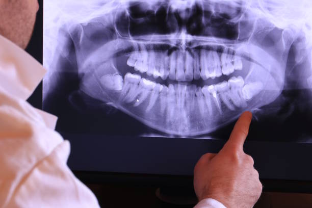Best Emergency Root Canal Treatment in Thorntown, IN