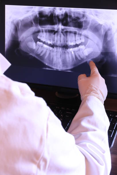 Best Emergency Wisdom Teeth Removal in Thorntown, IN